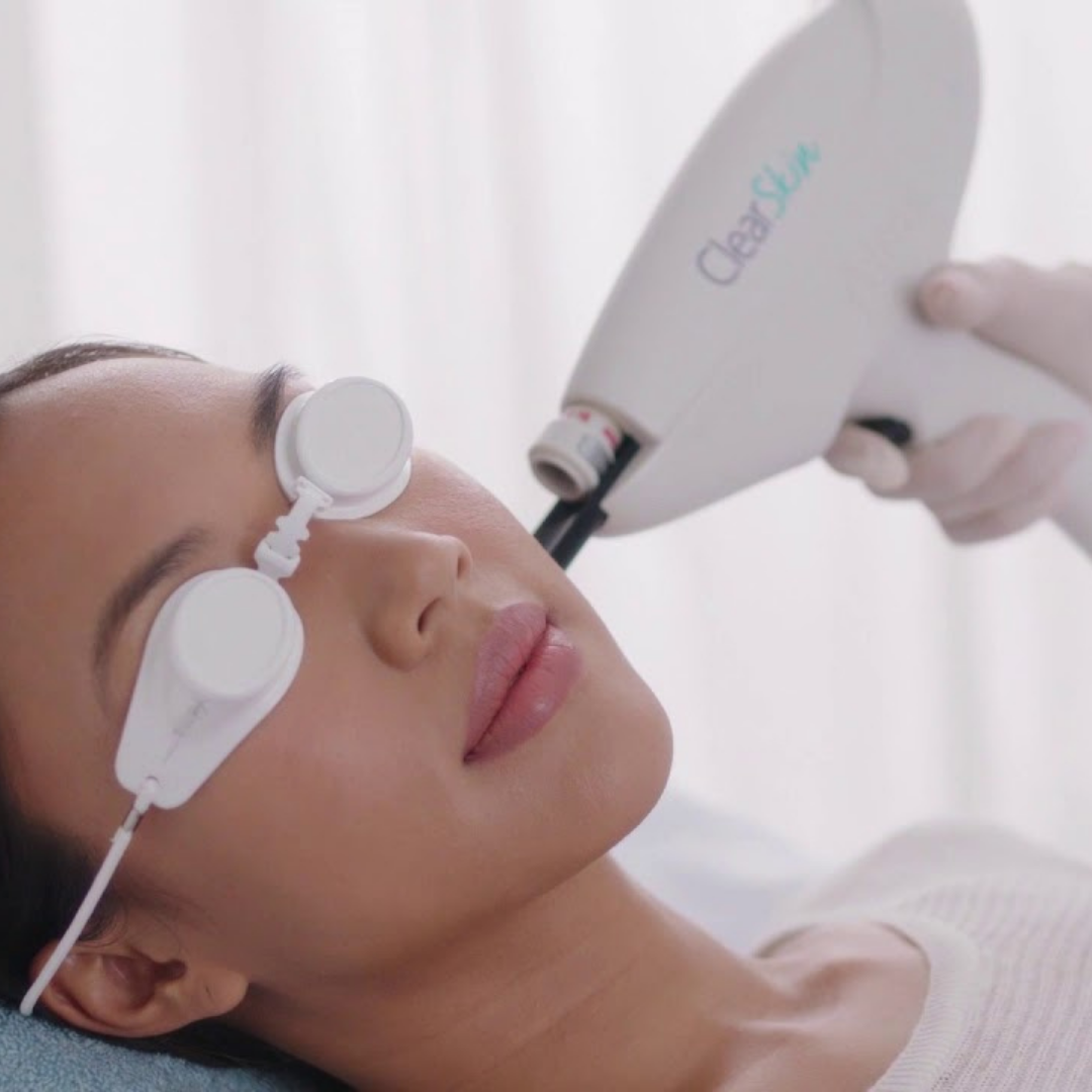 ClearLift Treatment Image