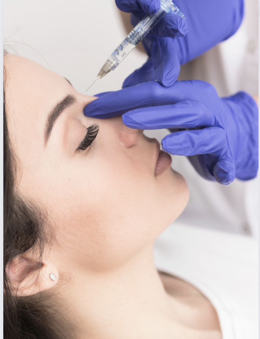 Non-Surgical Rhinoplasty Image