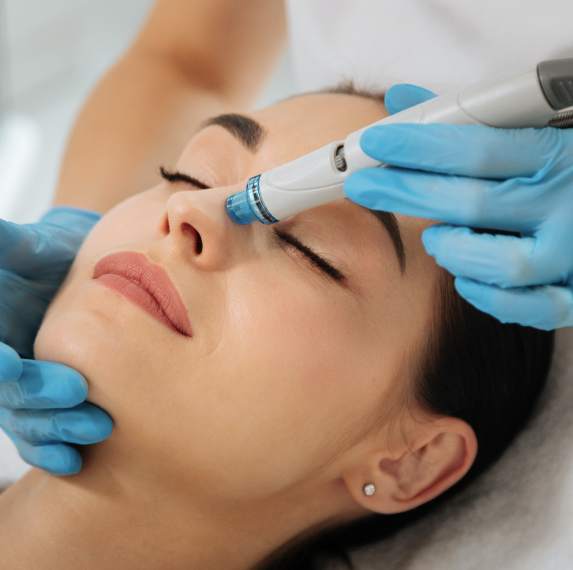 HydraFacial Image