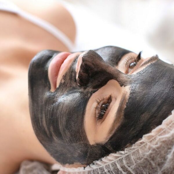 Carbon laser facial London