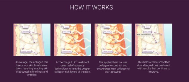 how does Thermage work