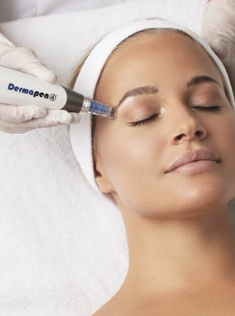 DermaPen london