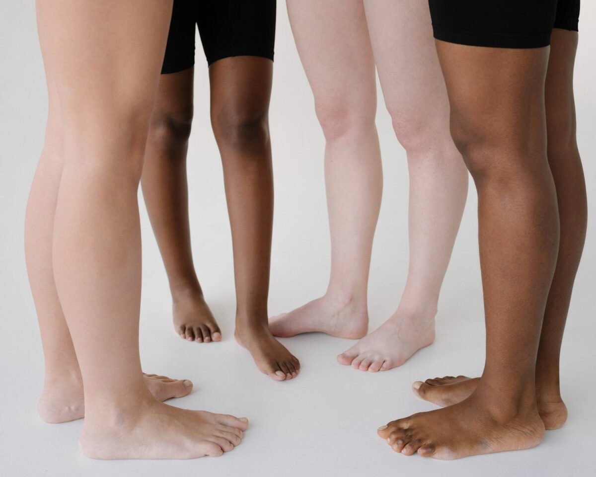Spider Vein Removal Image