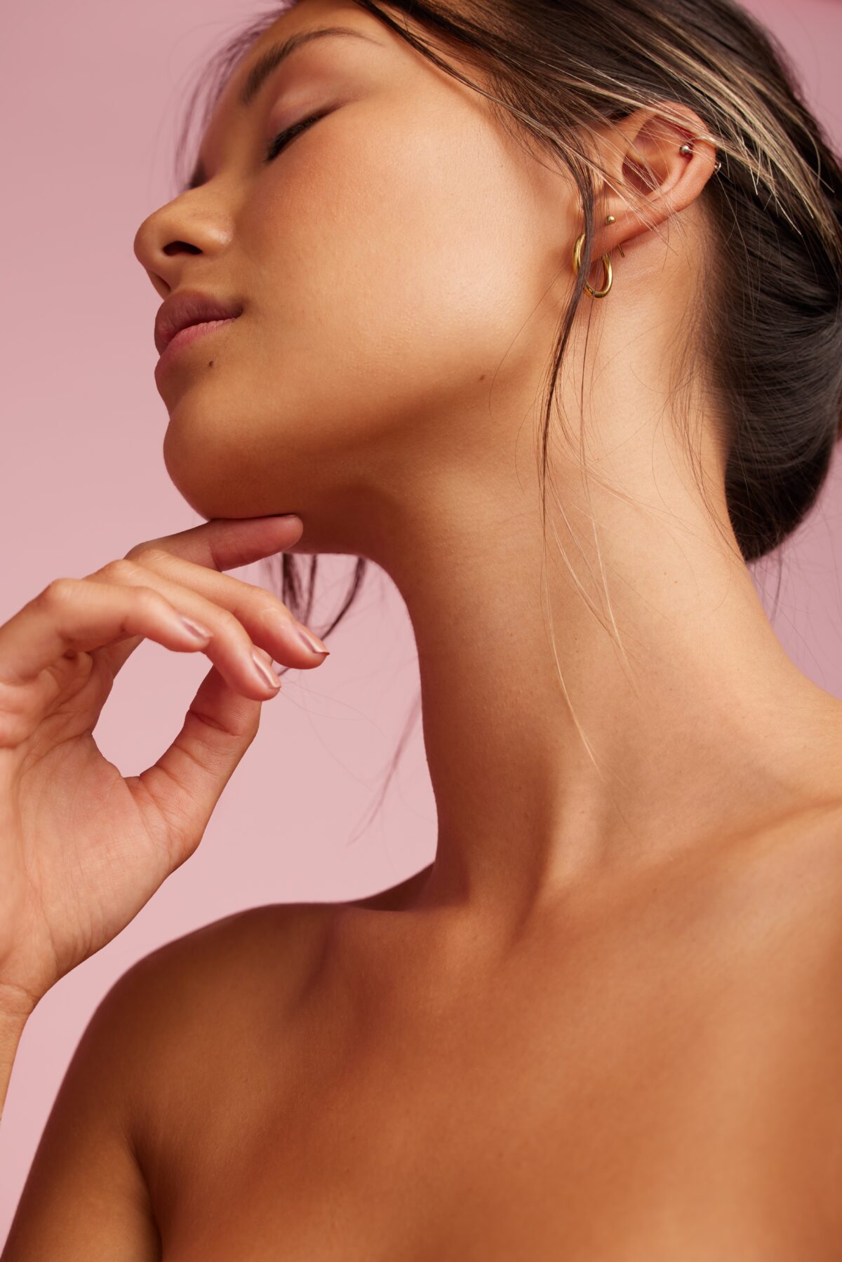 Buccal Fat Removal Image