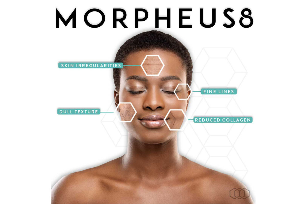 The Science Behind Morpheus8