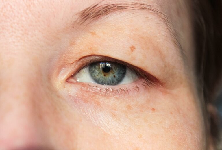 Double Eyelids Surgery, Procedures, Cost & Recovery Derma Revive Skin Clinic