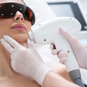 laser hair removal face area