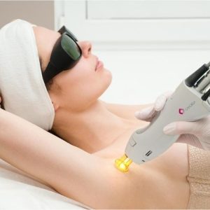 laser hair removal women packages