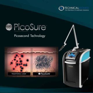 picosure laser treatment