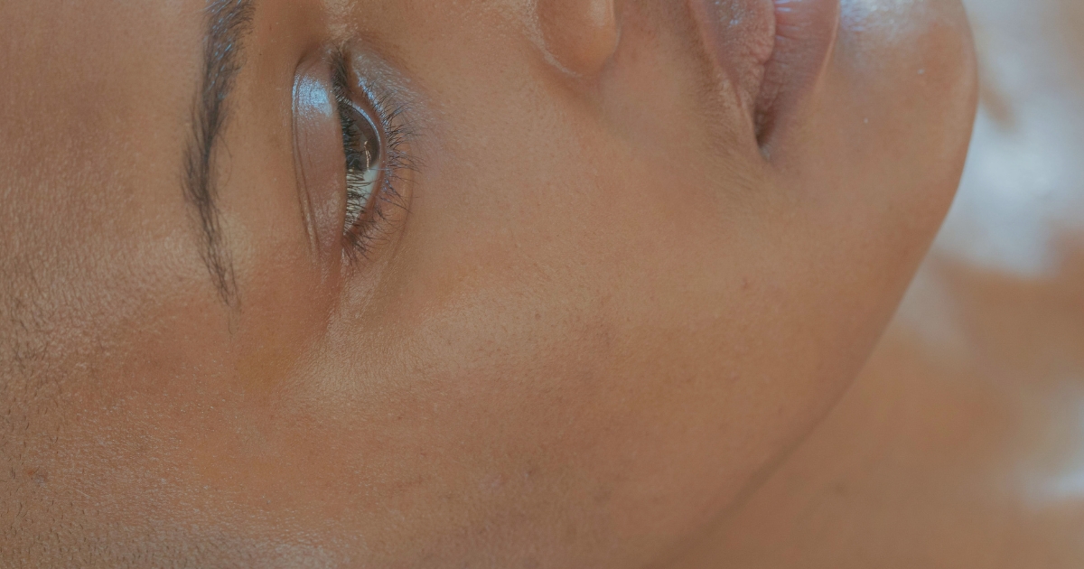 ClearSkin Pro at Derma Revive: Revolutionise Your Acne Treatment