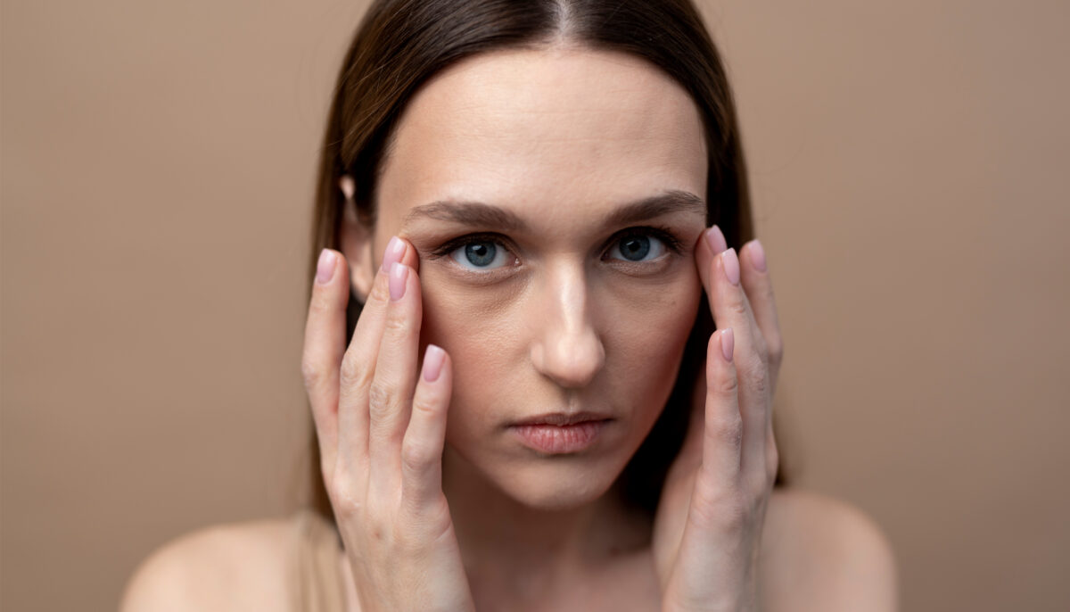 Does Thermage Help with Dark Circles Under the Eyes?