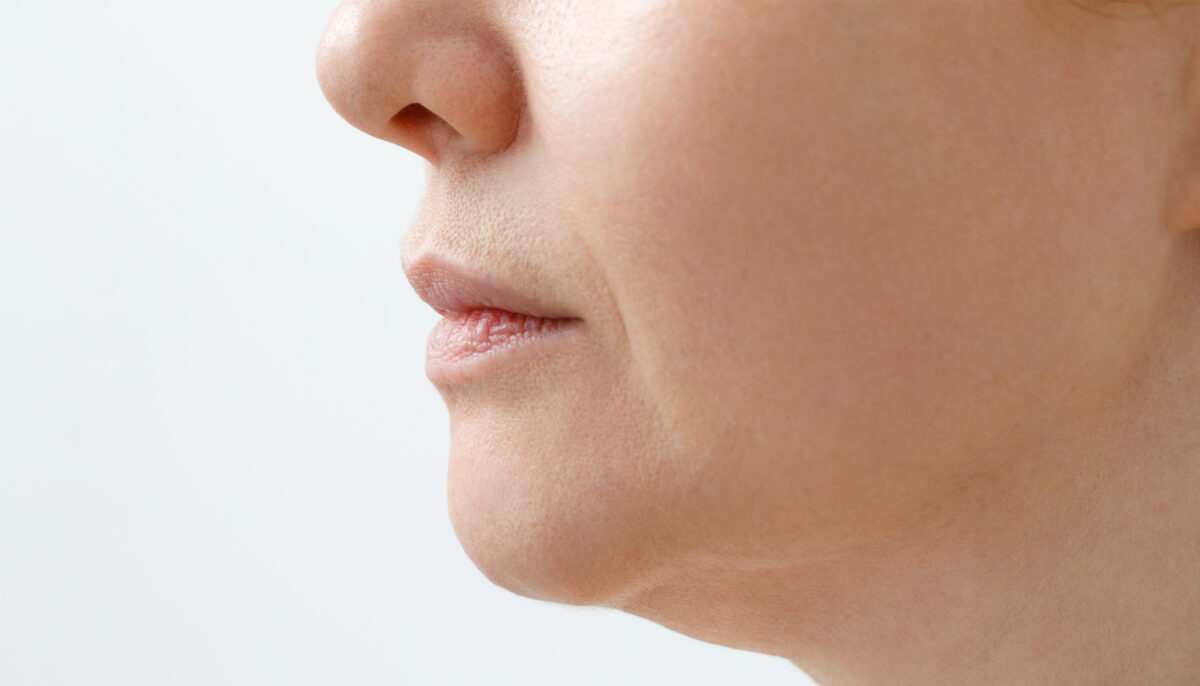 What Celebrities Do for Sagging Jowls?