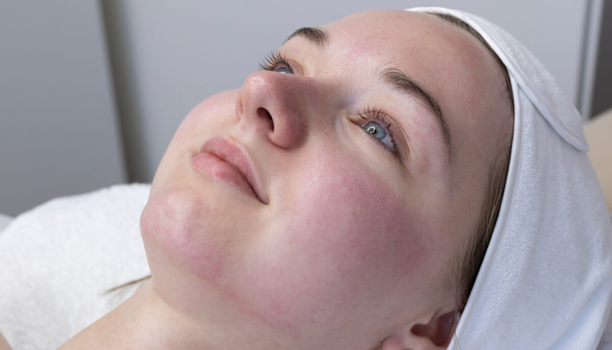 What Is the Best Cream to Use After Pico Laser?