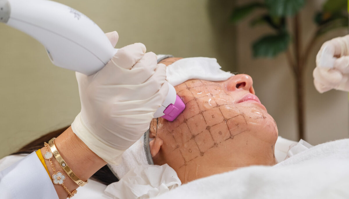 Do Celebrities Use Thermage?