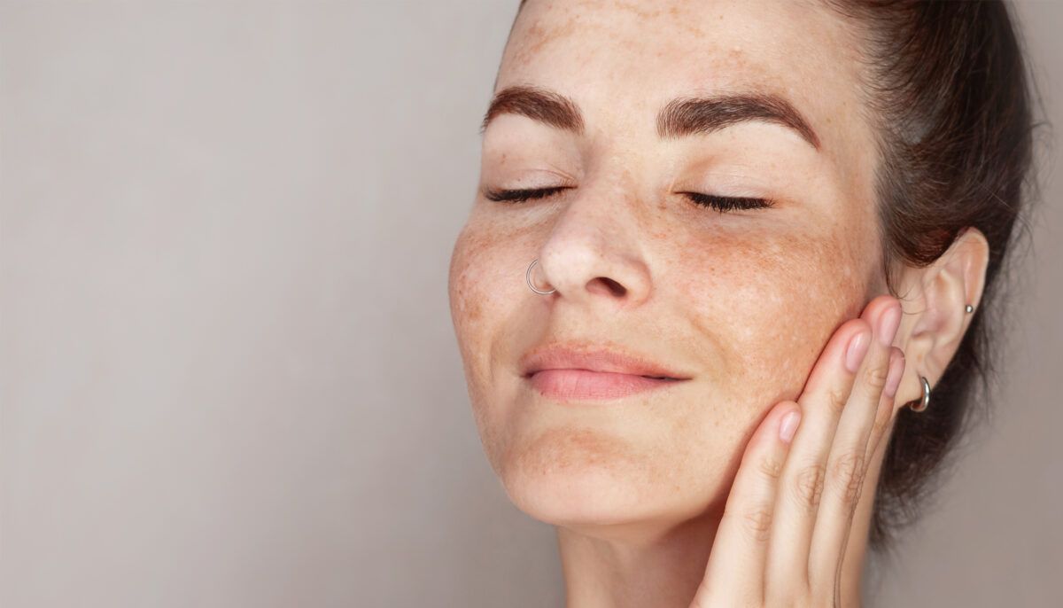How Many Sessions Does It Take to Remove Pigmentation?