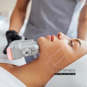 ULTHERAPY PRIME