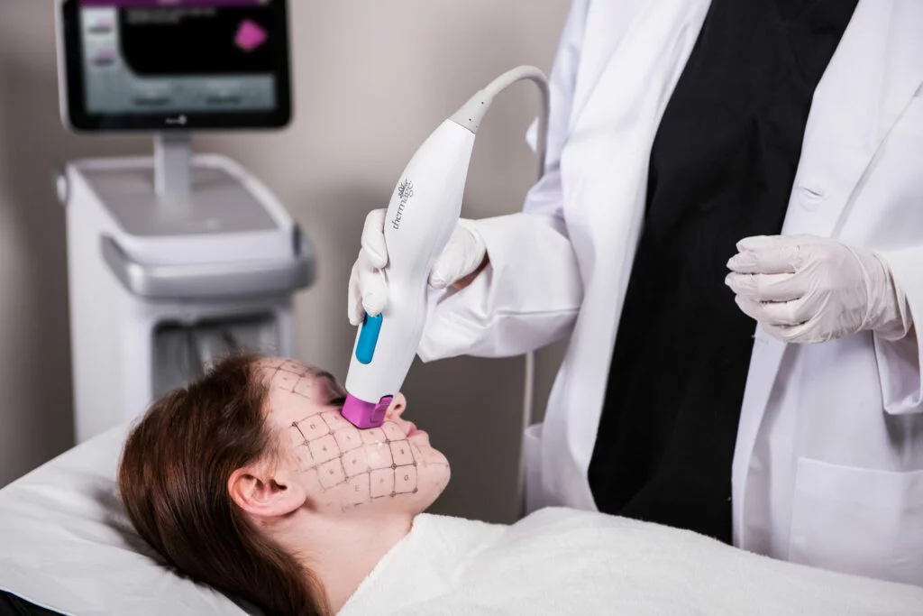 Woman having Thermage FLX treatment on her face