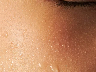excessive sweating skin