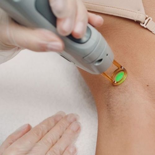 July Special Offer Laser Hair Removal