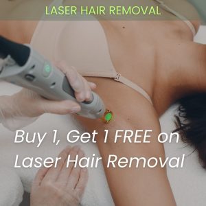 Special Offer: Buy One Get One Free Laser Hair Removal