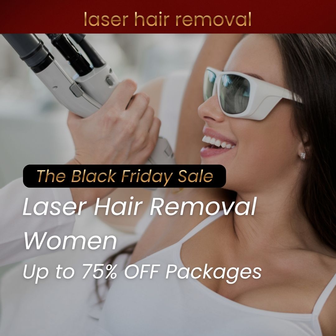 laser hair removal