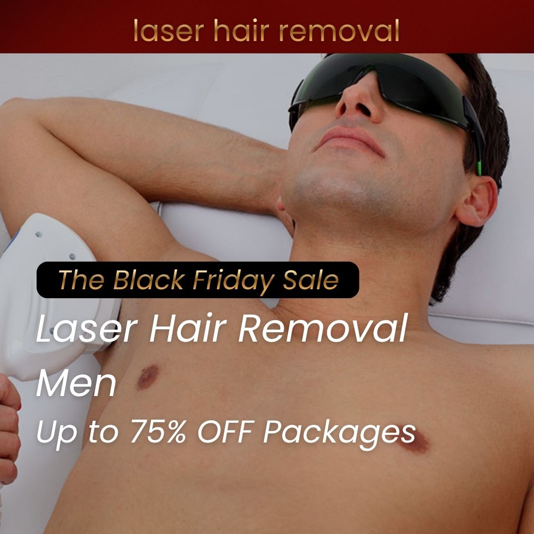 men’s laser hair removal packages