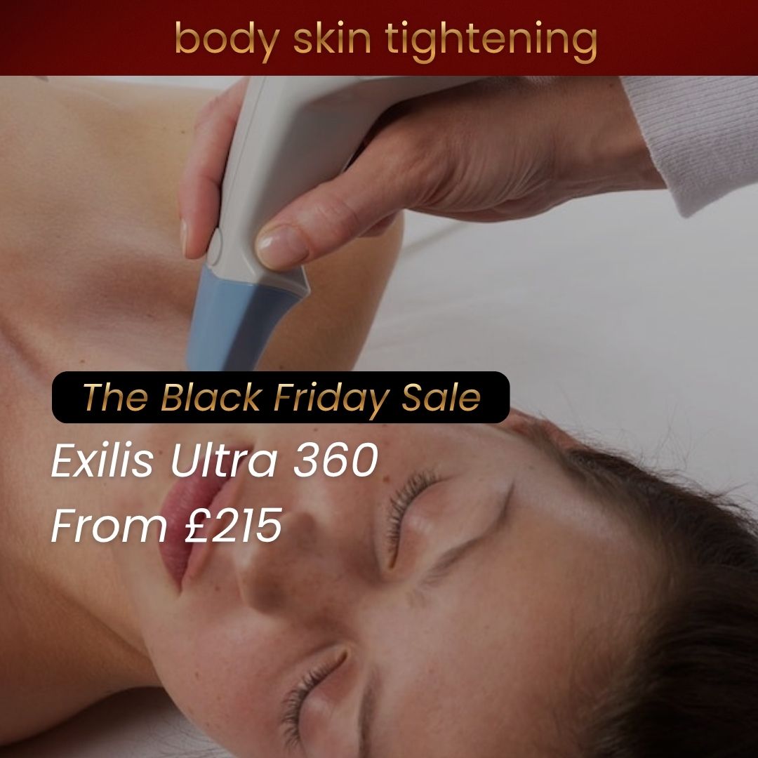 exilis skin treatment