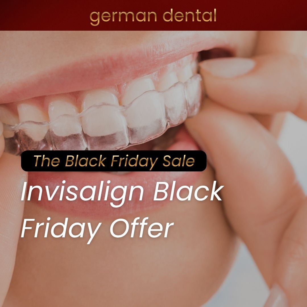 Invisalign