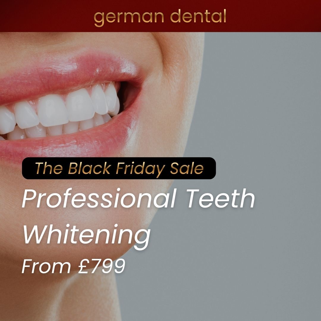 teeth whitening